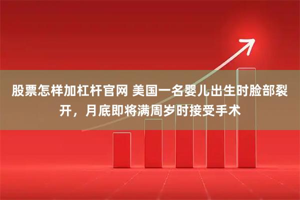 股票怎样加杠杆官网 美国一名婴儿出生时脸部裂开，月底即将满周岁时接受手术